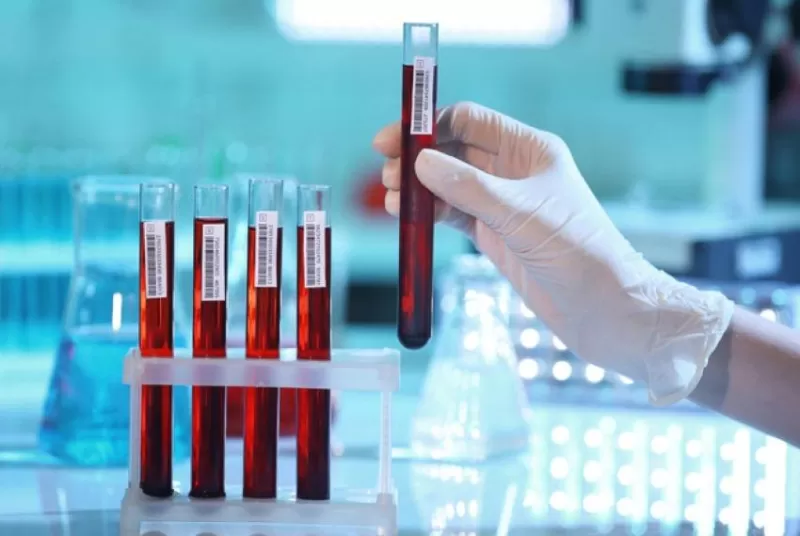 Серологическое исследование крови – один из методов диагностики эхинококкоза