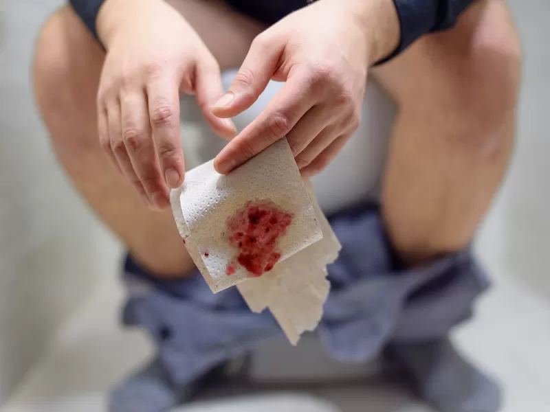 Кровь на туалетной бумаге после дефекации – признак геморроя и других, более опасных заболеваний кишечника <br/>Фото: shutterstock.com