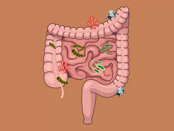 Дисбиоз кишечника: есть ли такая болезнь и как её лечить