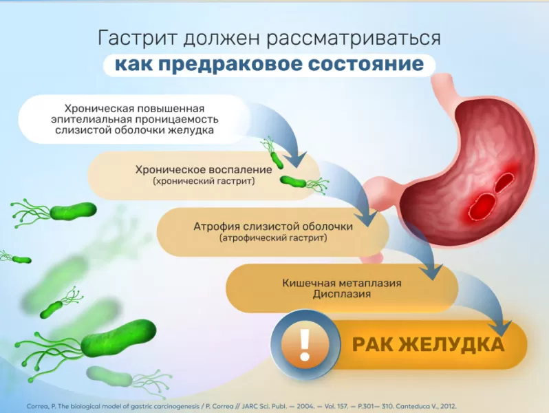 Каскад Correa показал, что H. pylori является канцерогеном первого порядка