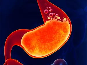 Гастрит с повышенной кислотностью