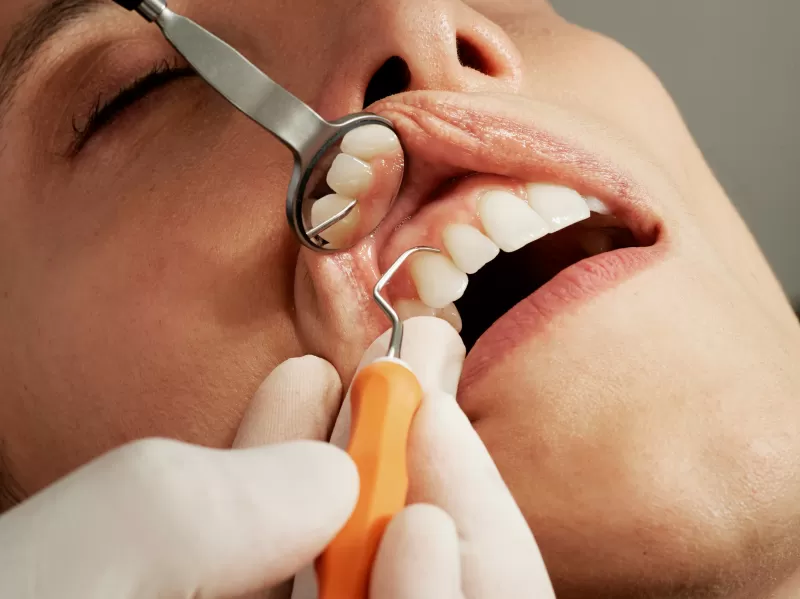 Галитоз часто связан с местными причинами — гигиеной полости рта, стоматологическими заболеваниями