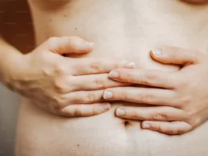 Язва желудка