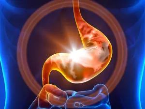 Острый гастрит