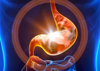 Острый гастрит