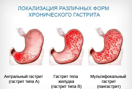 По лечению желудочно кишечного