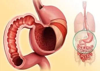 Не повреди: как боль в желудке и изжога связаны…