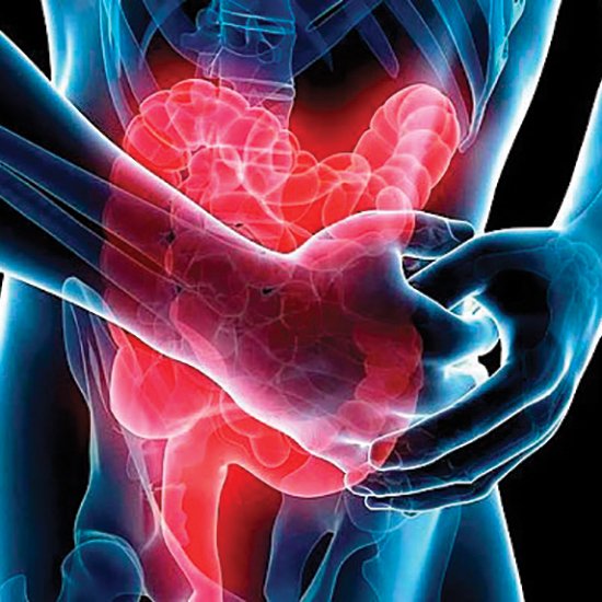 Колит ишемический