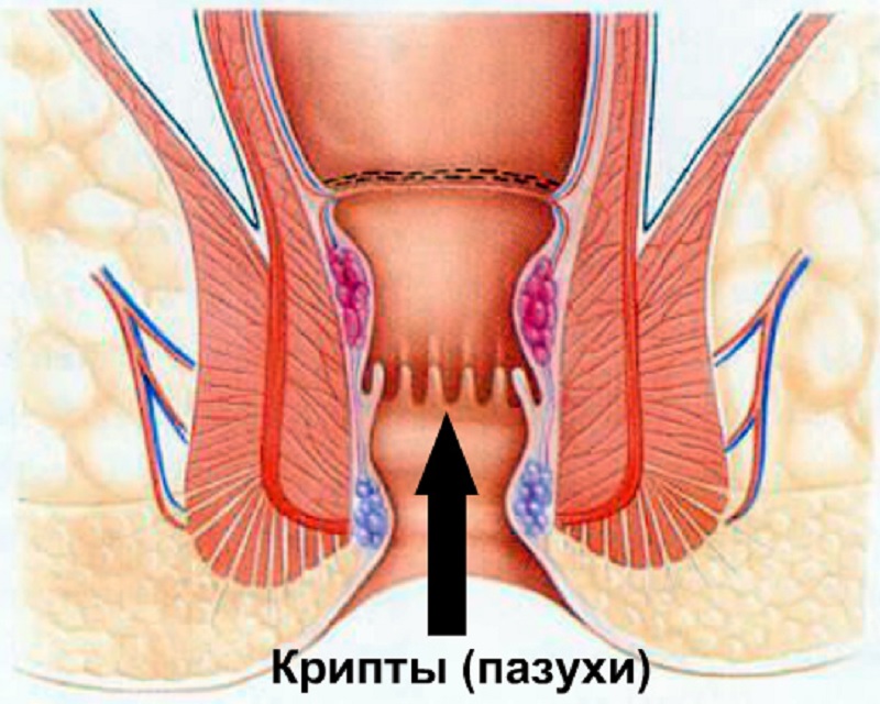 Свищ Фото Лечение