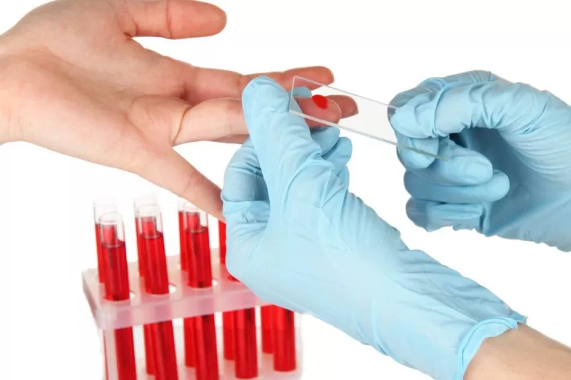 Биохимический анализ крови–один из методов диагностики жировой болезни печени
